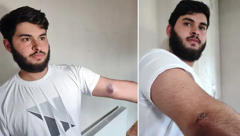 Topun Bahçeye Kaçması Mahallede Büyülü Anlar Yarattı